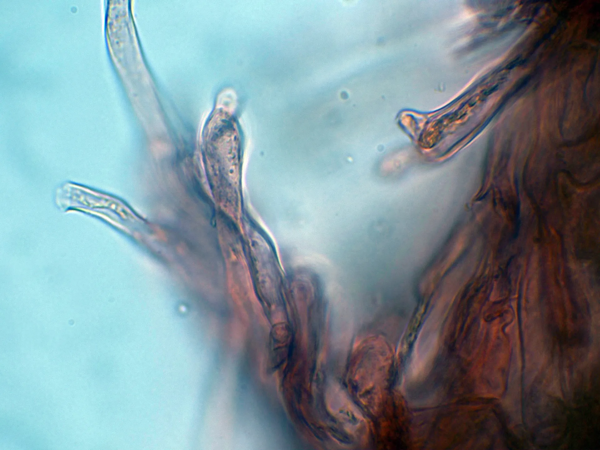Microscopía de Scutiger pes-caprae - 10 - Hifas trama-002